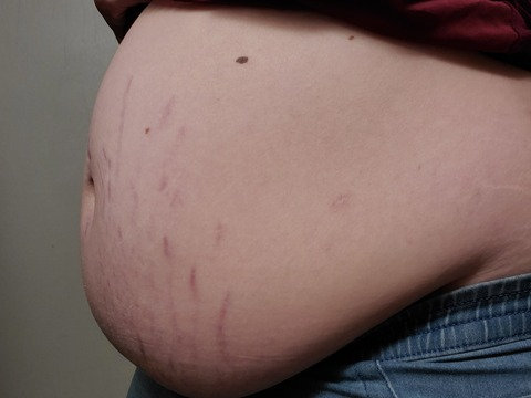 Снимка на заглавието на OnlyFans enk89